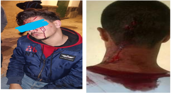 عضوي الشبيبة الاتحادية فرع تطوان يتعرضان للضرب بالسلاح الأبيض