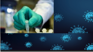 أستراليا/ بداية اختبار لقاح مضاد لفيروس كورونا